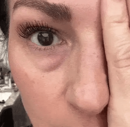 EyeLifter – Tratament 3 în 1 anti cearcăne 30ml